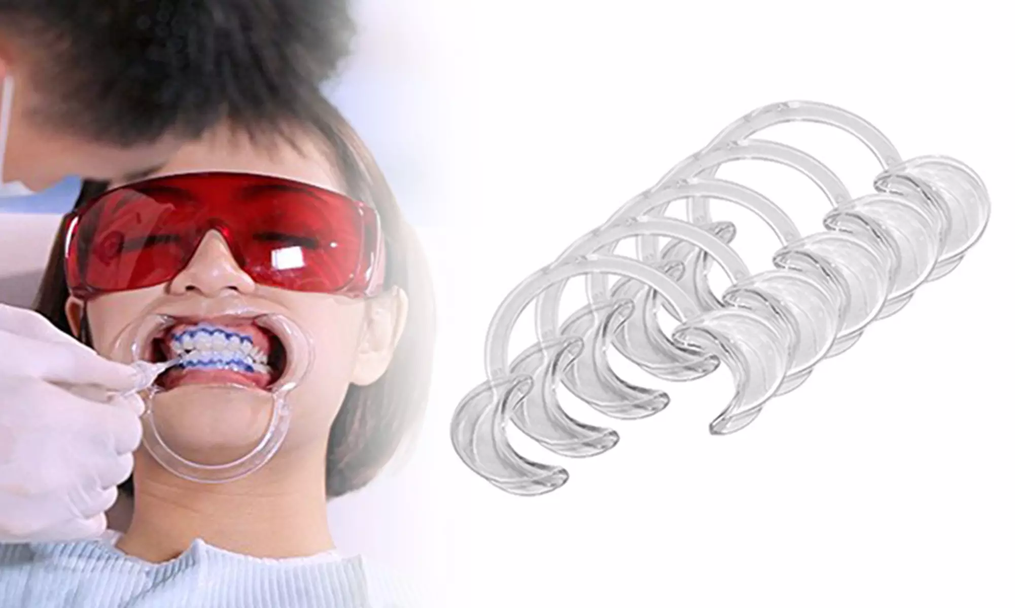 C-Shape Mouth Opener for Teeth Whitening Cheek Retractor Mouthguard Game - Primary Image