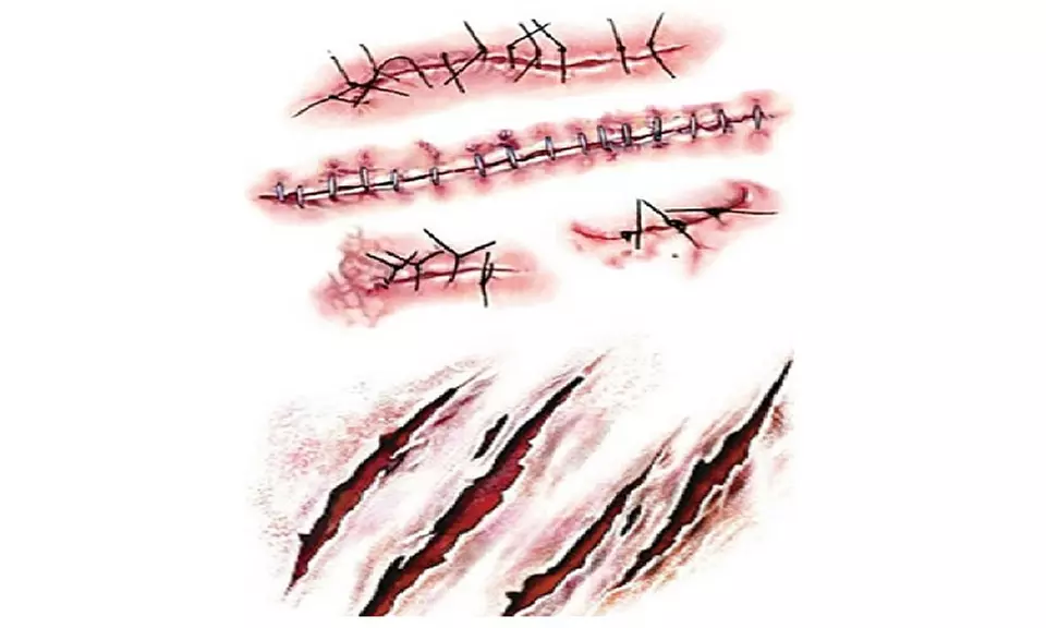 Halloween Zombie Scars Tattoos Set With Fake Scab - Primary Image