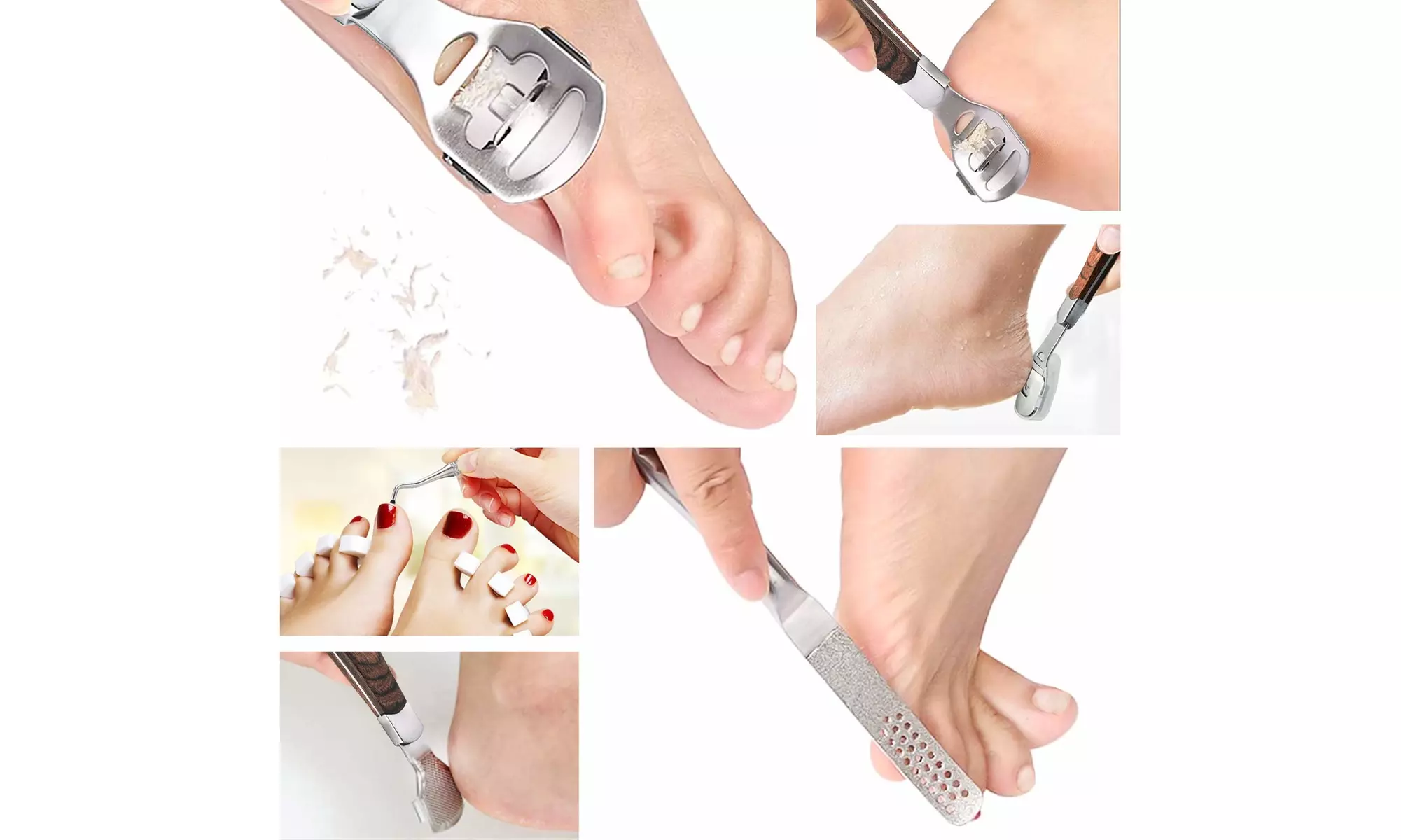 Callus Shaver, Foot Shaver Callus Remover for Feet Hand Care with Foot File - Second Medium