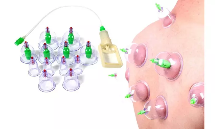 Chinese Vacuum Cupping Therapy Set Medical Healthy 6 Cup Hijama Set - Second Medium