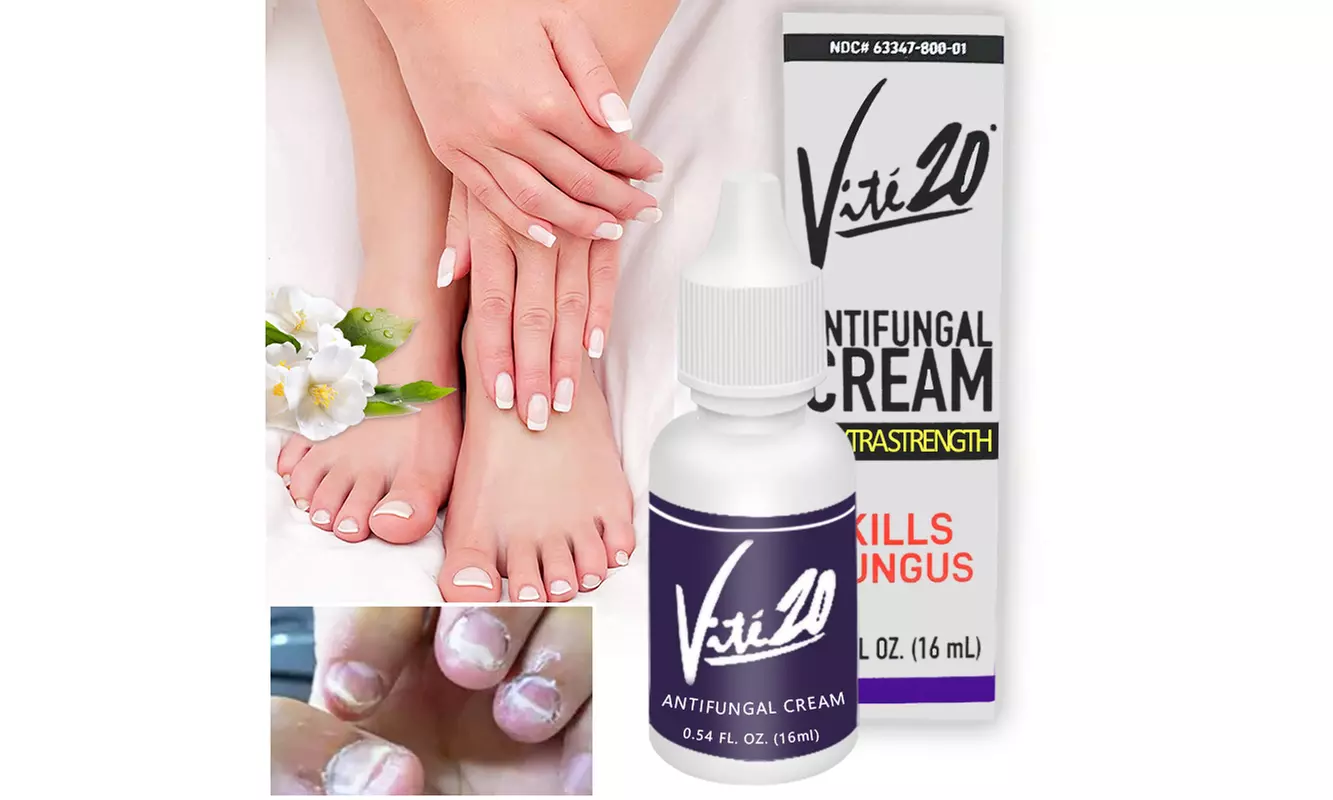Vite20 Antifungal Extra Strength Hand and Feet Antifungal Cream 0.54oz/16ml - Primary Image