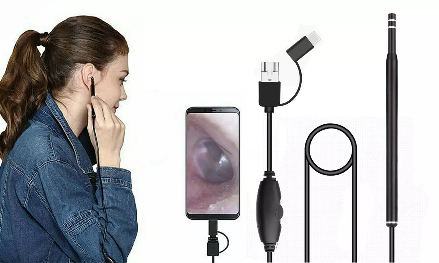 Digital Led Otoscope Ear Camera Scope Earwax Removal Kit for Android - Primary Image