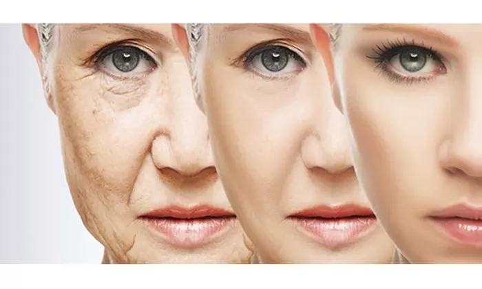 PLEXADERM Rapid Reduction Cream PLUS New & Sealed Under Eye Bags Wrinkles 5ml - Second Medium