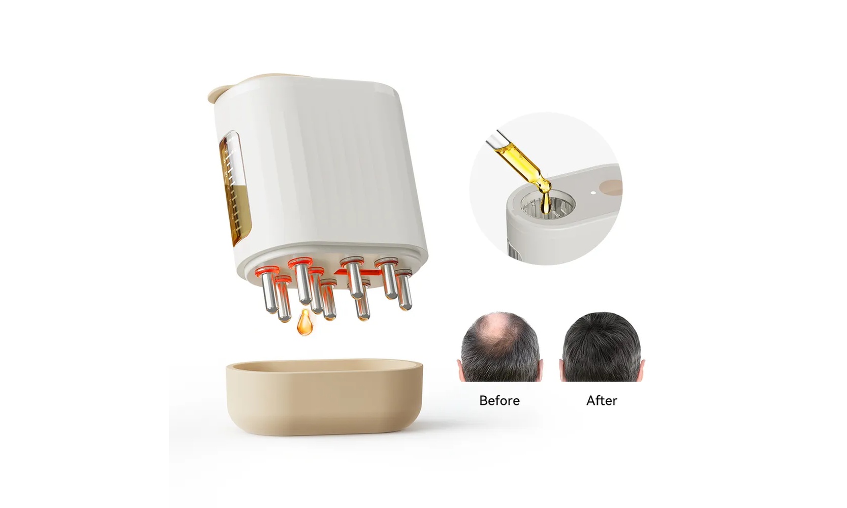 Electric Oil Applicator and Vibration Deep Scalp Massager - Promotes Hair Growth