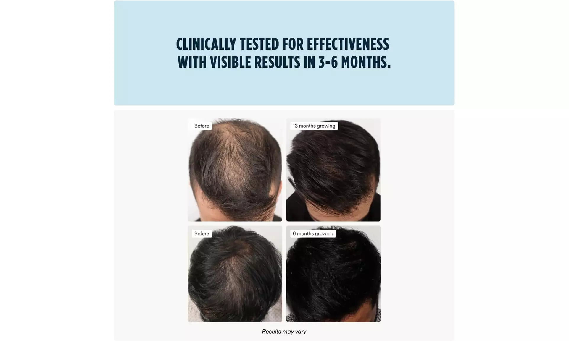 Nutrafol Hair Growth Supplements 