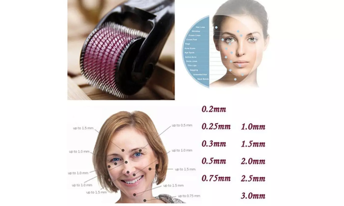 540 Micro Needle Derma Skin Roller Anti-aging Deep Scars Acne - Second Medium