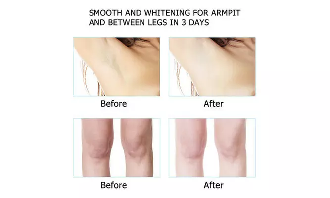 Skin Lightening Whitening Body Face Cream Private Part Intimate Bleaching Cream - Second Medium