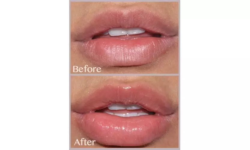 Women's Lip Enhancer Pump Big Luscious For Party Cosmetic Tool - Second Medium