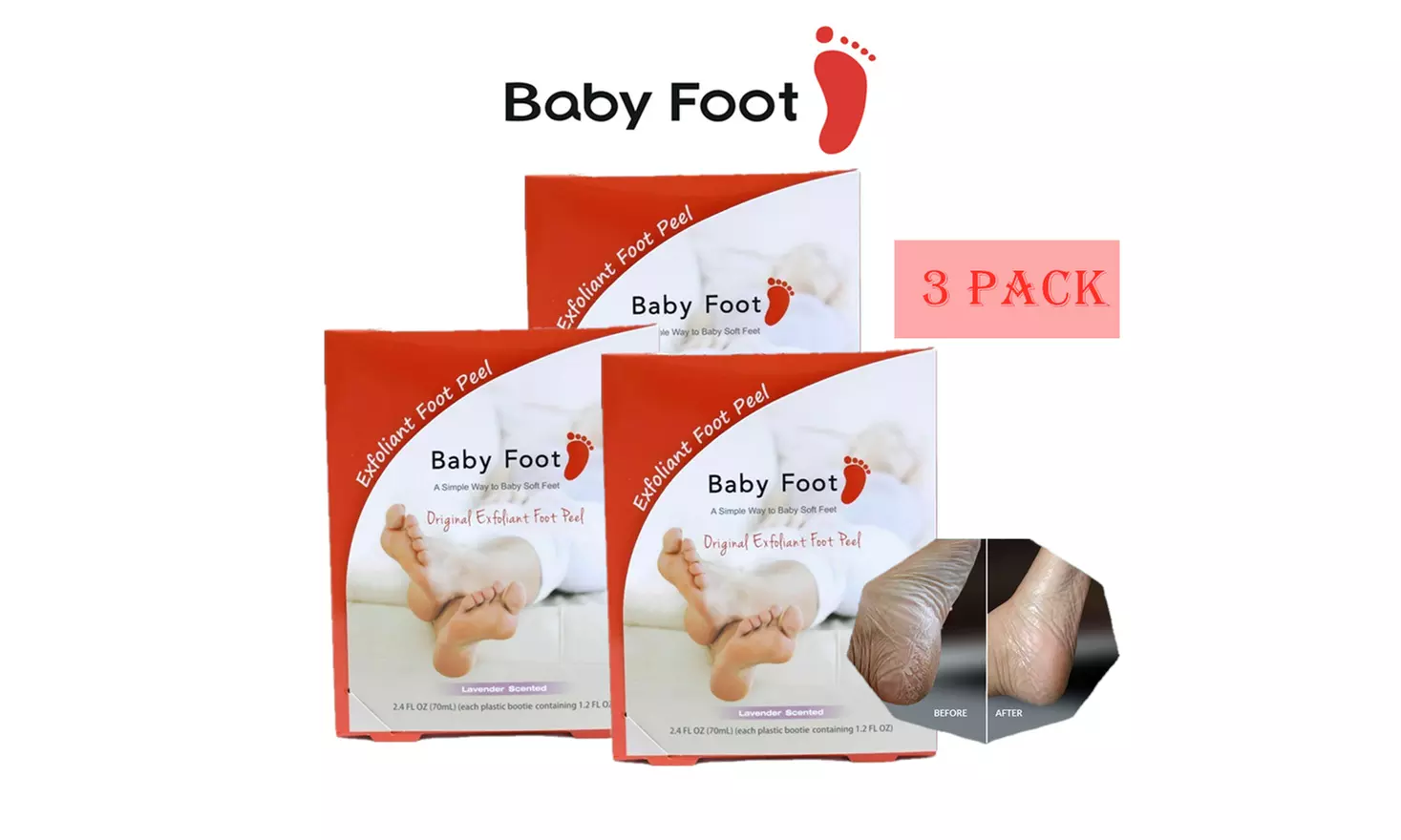 Baby Foot - Original Exfoliant Foot Peel -Lavender Scent Pair -Foot Mask- Unisex - Primary Image