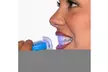 Teeth Whitening Gel In 10 Minutes Long Lasting Result - Second Medium