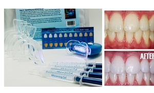 Teeth Whitening Kit with LED Light & 20 Treatments