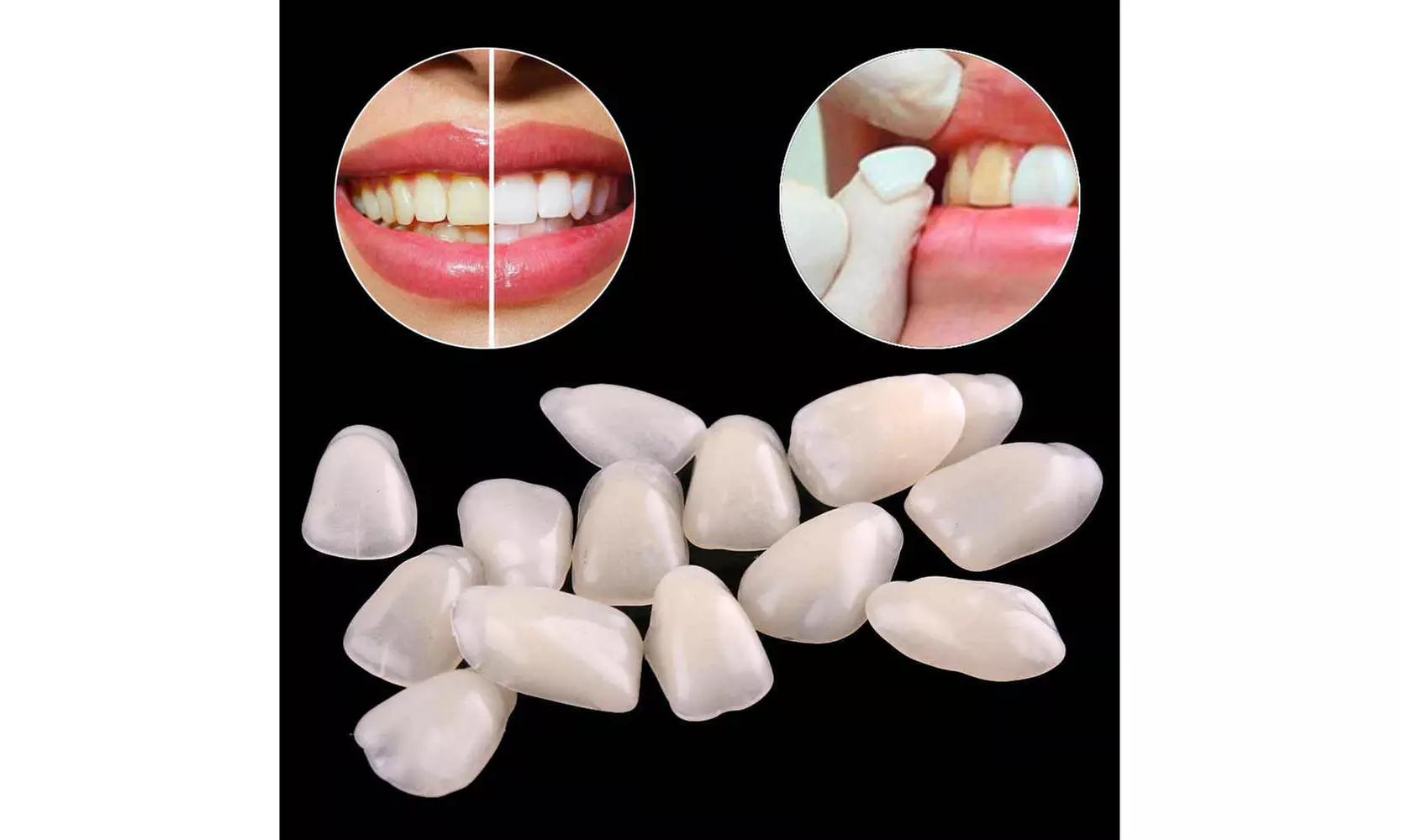 Oral Care Dental Ultra-Thin Whitening Resin Teeth Upper Anterior Shade  - Primary Image