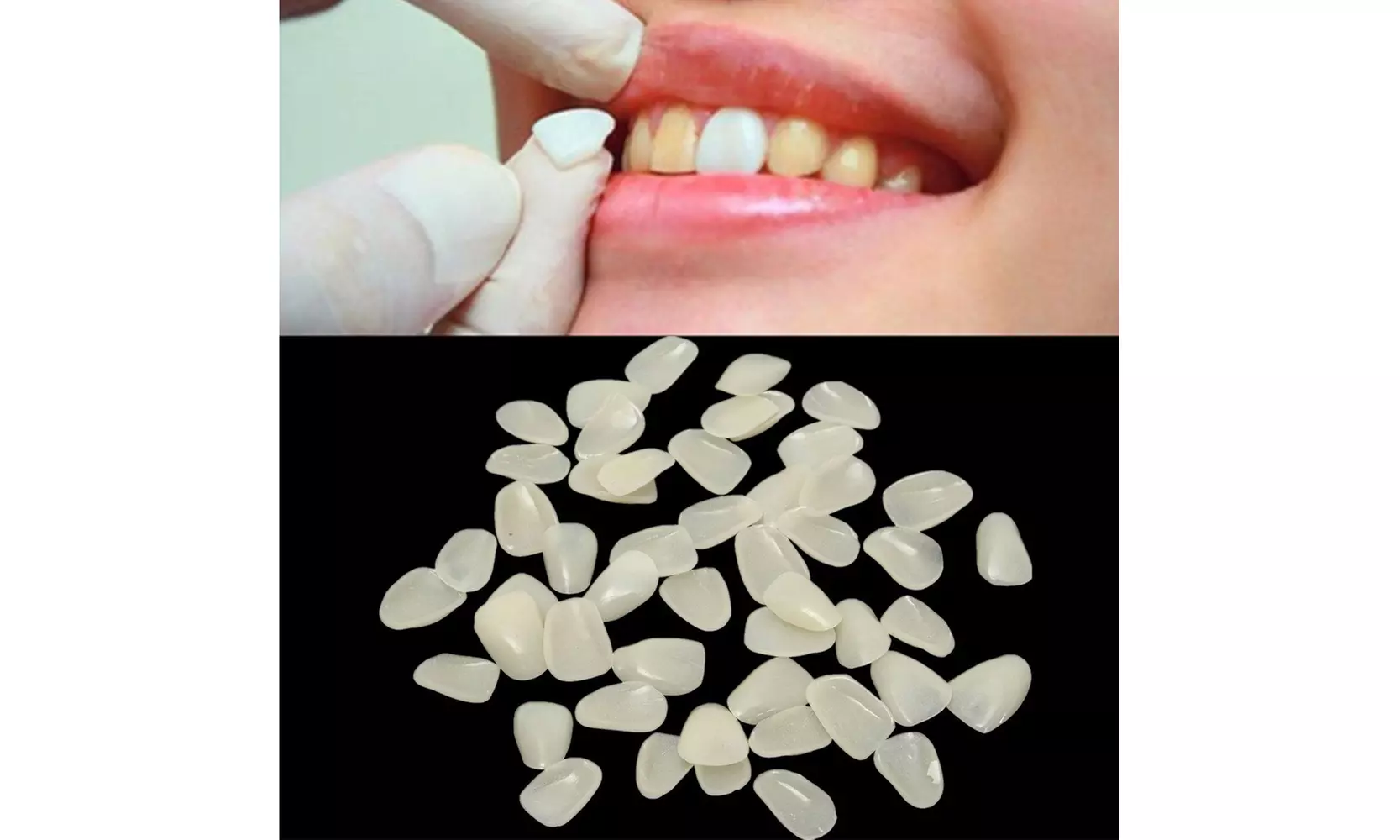 Oral Care Dental Ultra-Thin Whitening Resin Teeth Upper Anterior Shade  - Second Medium