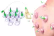 Cupping 6 Cups Household Therapy Equipment Massage Acupuncture Hijama Set - Second Medium