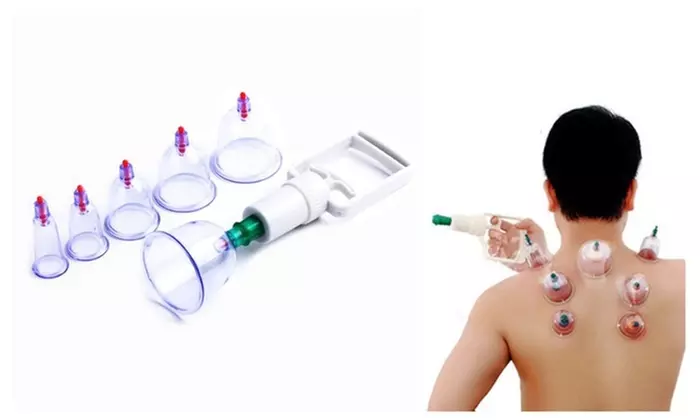 6 Cups New Chinese Medical Vacuum Body Massager Hijama Cupping Set - Primary Image