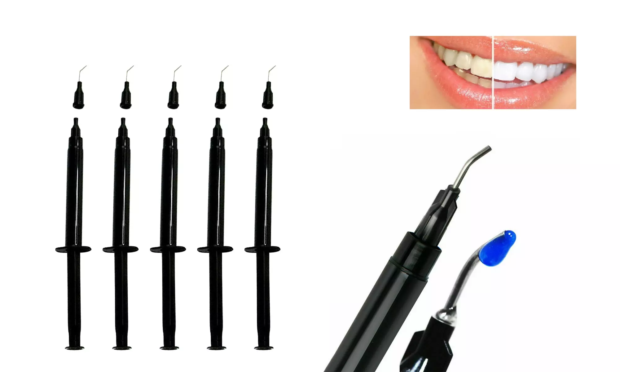 1.5ml FDA Gingival Gum Protector Syringe Before Teeth Whitening Gel Black 5pcs - Primary Image