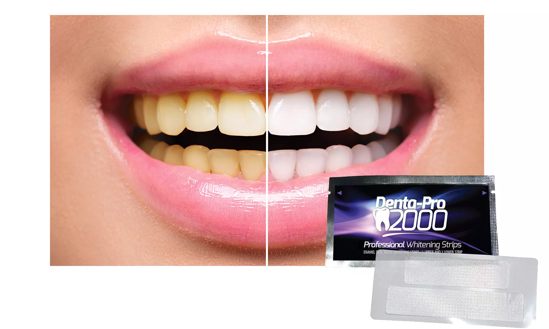 DentaPro2000 At Home Professional Teeth Whitening Strips - 28 Count - Second Medium