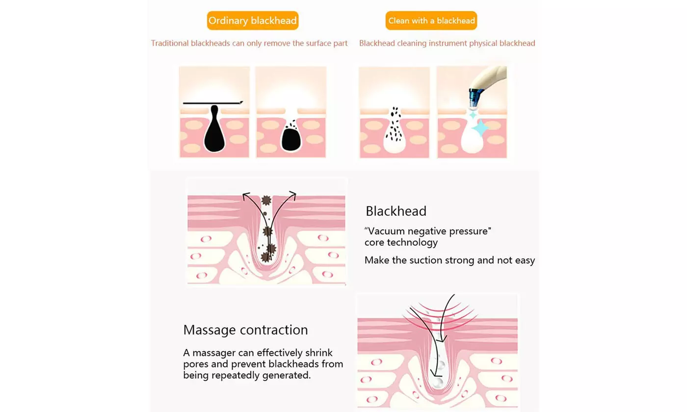 Electric Blackhead Remover Vacuum Facial Pore Cleanser Acne Suction Extractor