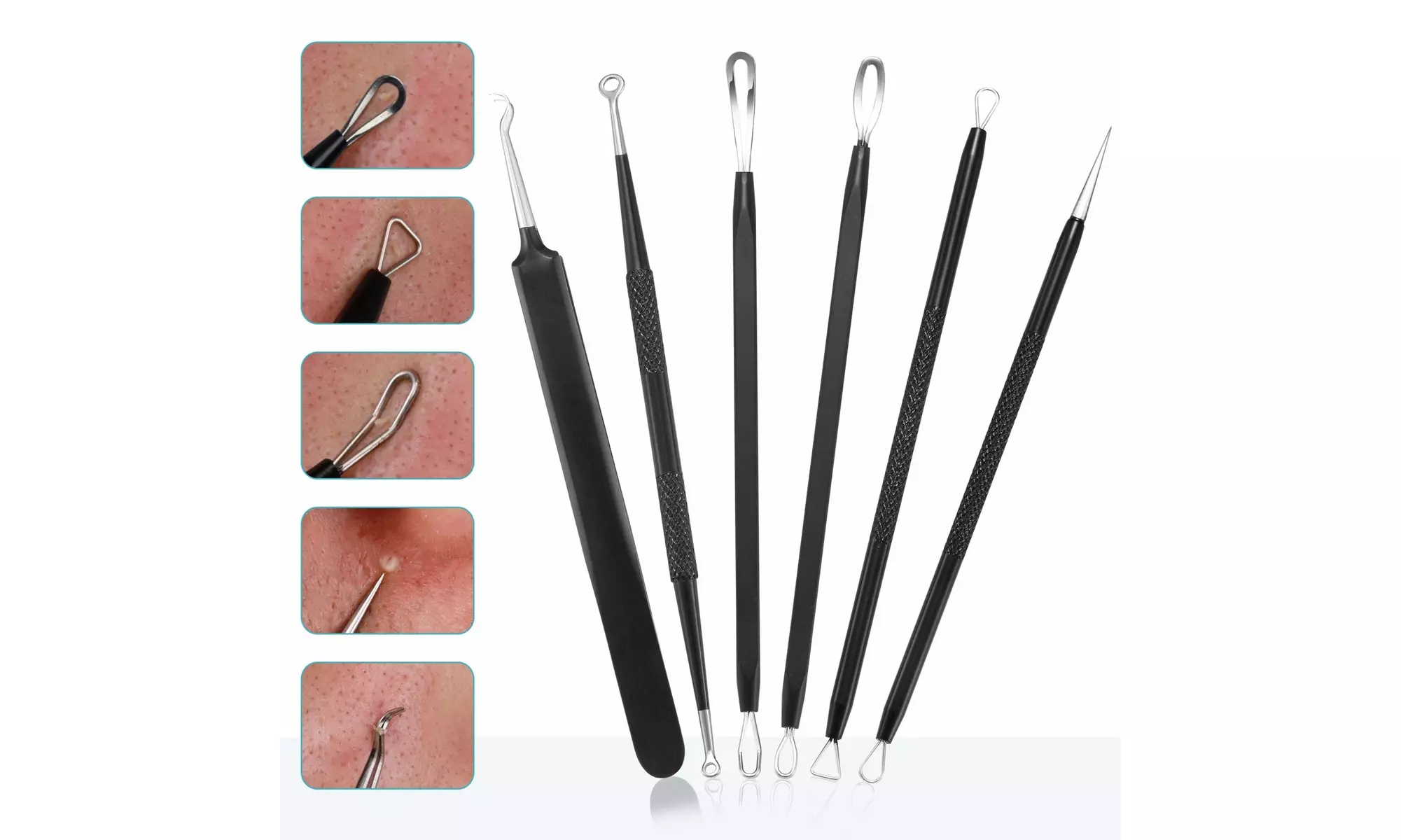Blackhead Remover Pimple Popper Tool Kit - (6 Piece Kit) - Primary Image