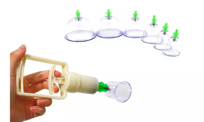 Chinese Vacuum Cupping Therapy Set Medical Healthy 6 Cup Hijama Set - Primary Image