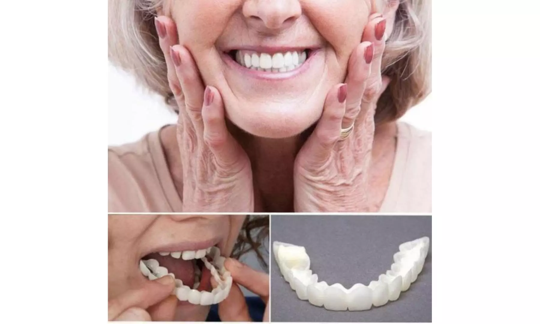 Perfect Smile Snap-On Braces - Primary Image