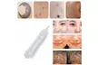 Spot Removal Pen Plasma Dot Mole Removal Sweep Spot Pen Set - Second Medium