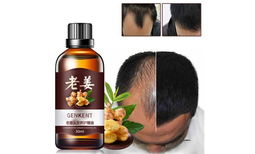 Fast Hair Growth Dense Regrowth Ginger Serum Oil Anti Loss Treatment Groupon