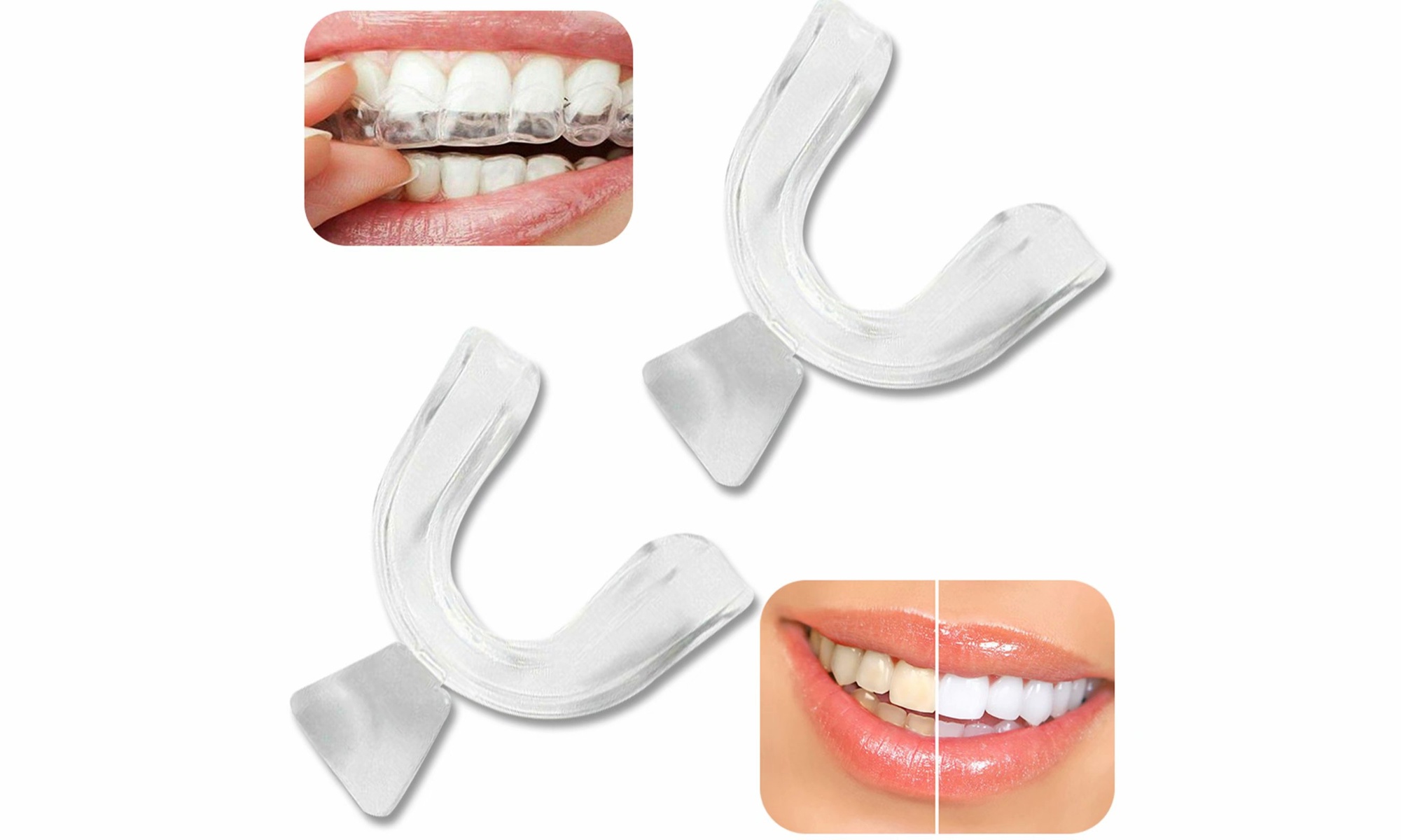 Moldable Mouth Tray Teeth Whitening Tray Mouth Guard Whitening Tray(4- 8- 12pcs)