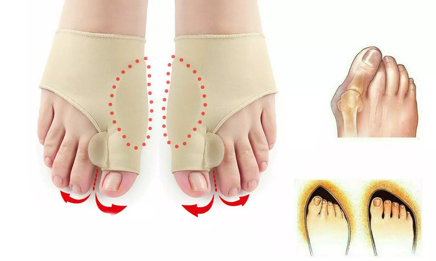 Big Toe Bunion Splint Straightener Corrector Relief Hallux Valgus Pain - Primary Image