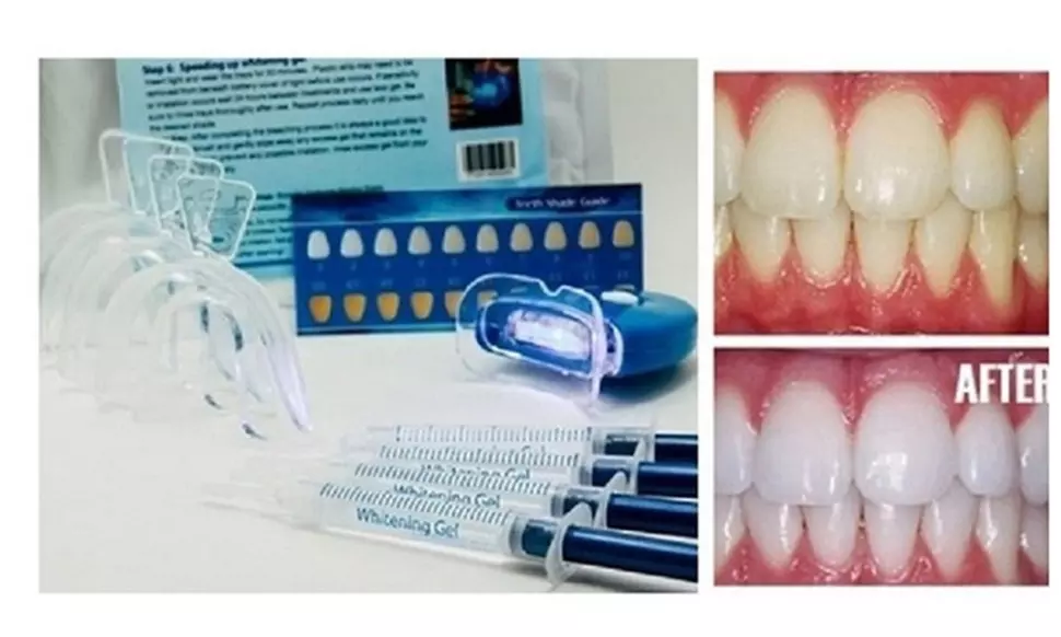 Professional 3D Teeth Whitening Kit w Remineralization Gel: 1 & 2 pack
