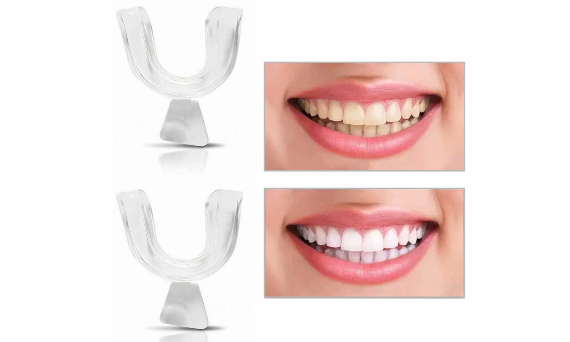 Moldable Mouth Tray Teeth Whitening Tray Mouth Guard Whitening Tray(4- 8- 12pcs)