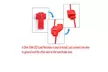 10pcs Load Resistor 50W 6RJ LED Decoder Fix Error Code Hyper Flash Turn Signal - Second Medium