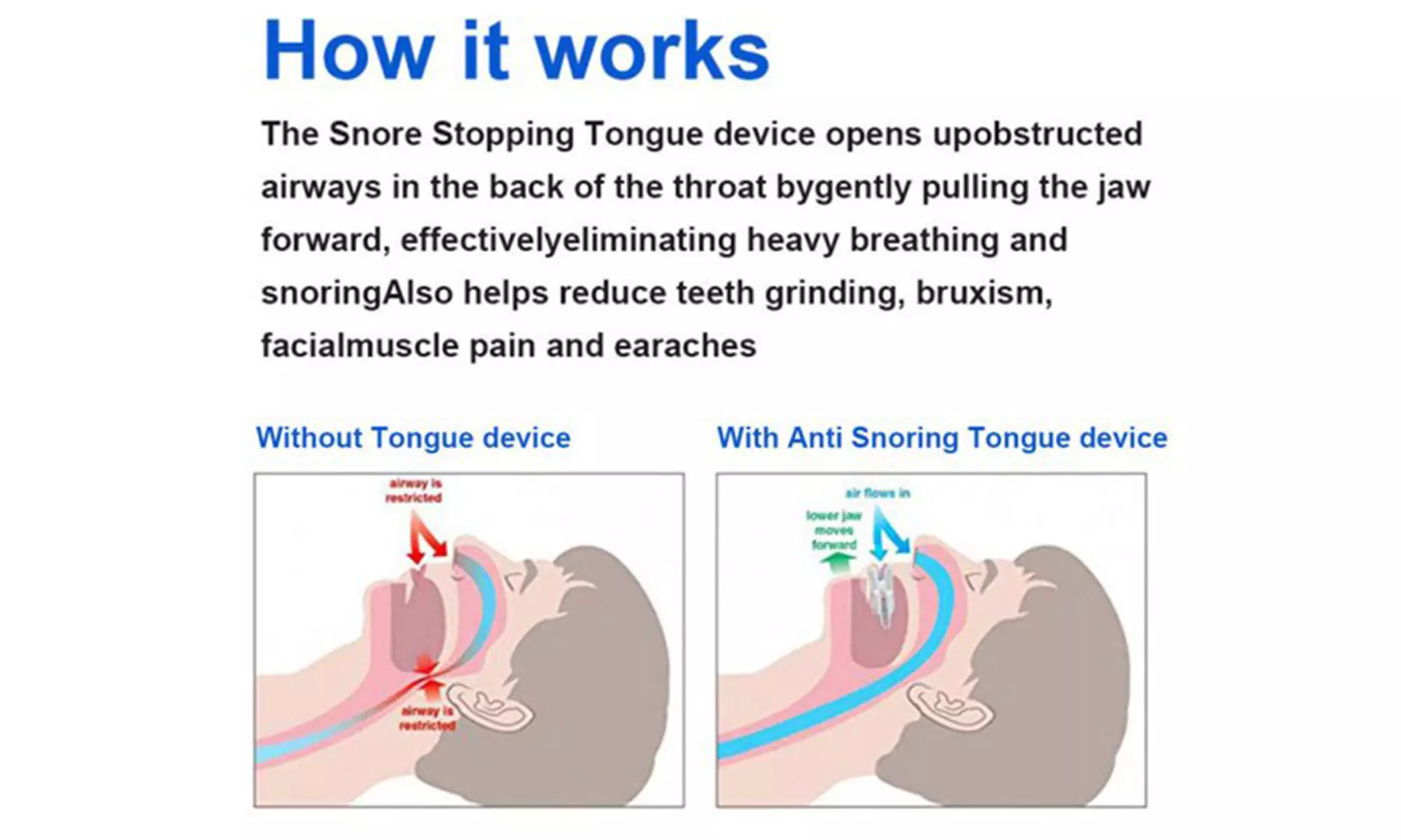 Anti Snoring Devices 2Pcs Anti Snoring Tongue & 2Pcs Nose Clip Snoring Solution