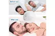 4pcs Anti Snoring Tongue Device Silicone Sleep Effective Stop Snoring Device - Second Medium