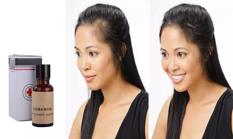 Essence Hair Treatment for Loss Prevention and Growth Serum - Primary Image
