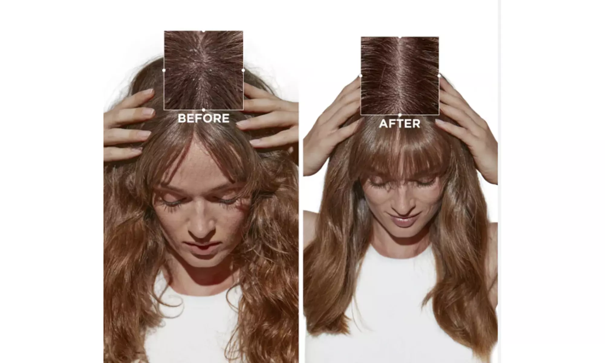 Kérastase Symbiose Anti-Dandruff Scalp Scrub & Soothing Conditioner