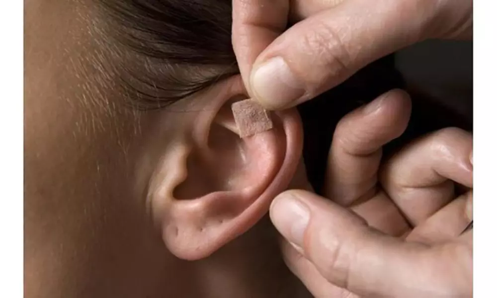 Auricular Therapy Vaccaria Ear Seeds 600 Pack ( Helps Quit Smoking/Lose Weight ) - Second Medium