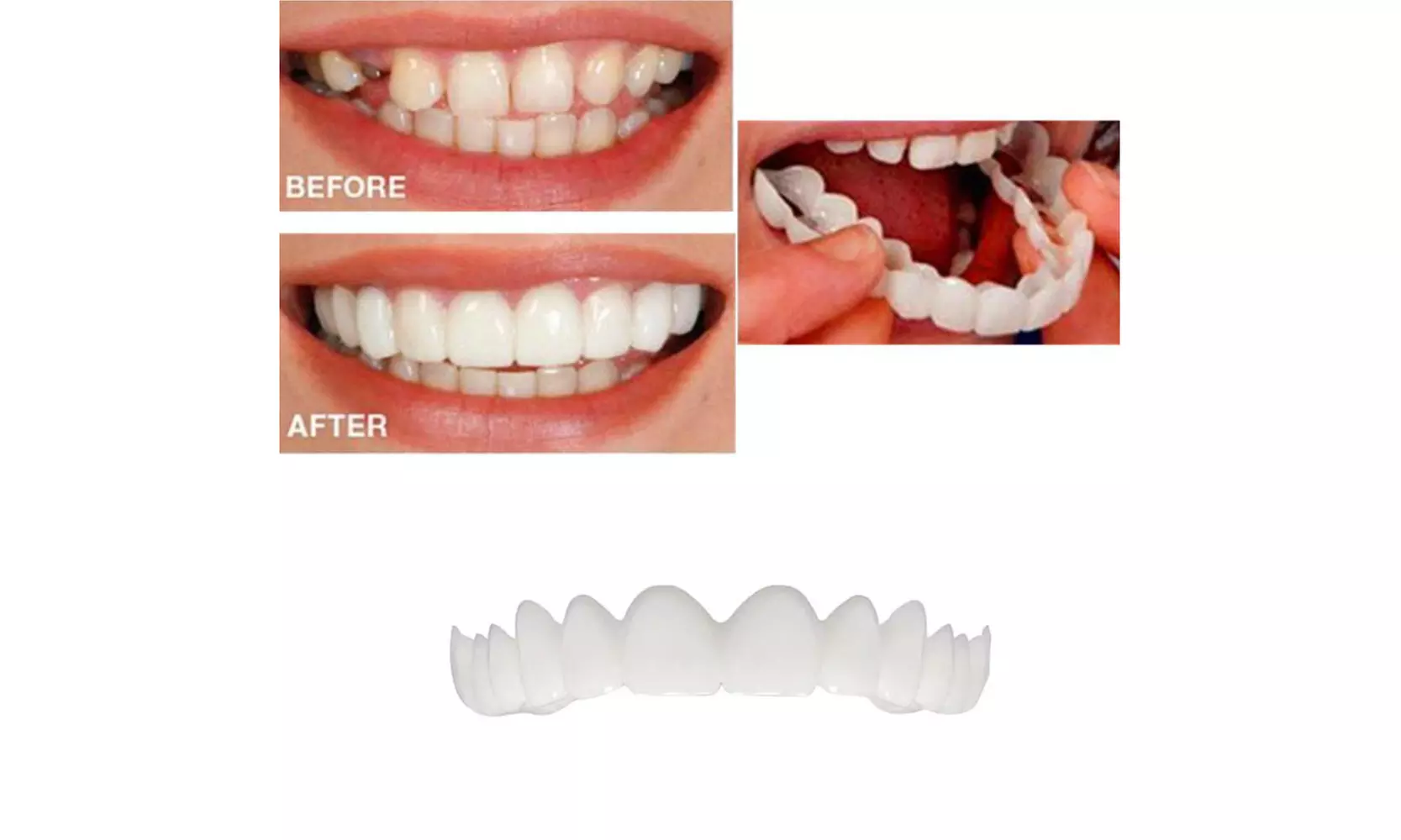 Wuuynn 2Pcs Comfort Fit Flex Cosmetic Teeth Denture Teeth Top Cosmetic Veneer - Second Medium
