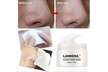 LANBENA Pore Strips Blackhead Remover Nose Acne Cleansing Peel Off Mud Mask - Second Medium