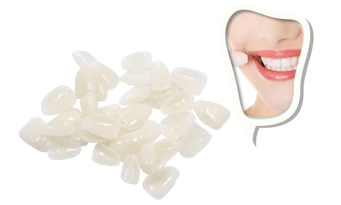 Dental Ultra-Thin Whitening Resin Teeth Upper Anterior Shade For Dental Use Only