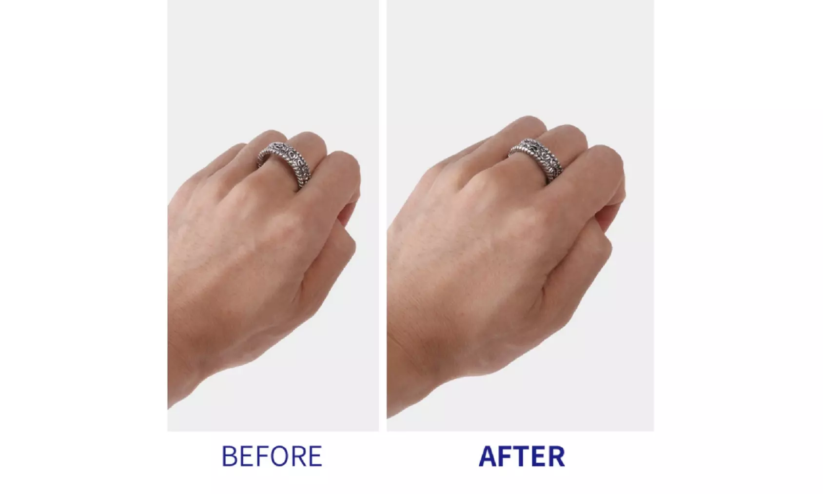 8Pcs Ring Size Adjuster Invisible Clear Ring Sizer Jewelry Fit Reducer Guard US - Second Medium