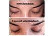 Grande Cosmetics GrandeLASH-MD Eyelash Enhancing Serum, 2ml - Second Medium