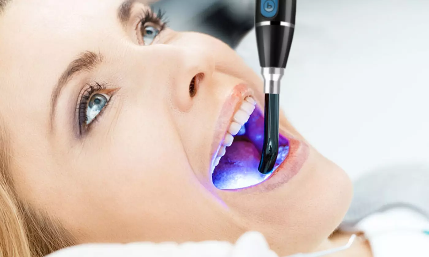 iMounTEK 5W 1500mw/cm2 Dental Cordless LED Curing Light Lamp