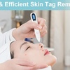 Image 2: ItBelongs2U Electric Laser Freckle Removal Pen for Moles, Spots, and Skin Tags