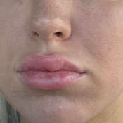 Photo submitted by Shelby