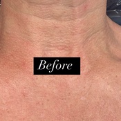 Photo submitted by Almira