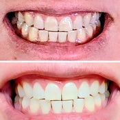 Photo submitted by BB