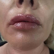 Photo submitted by candice