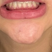 Photo submitted by Hala