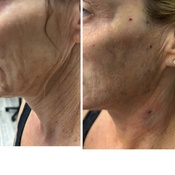 Photo submitted by Denise